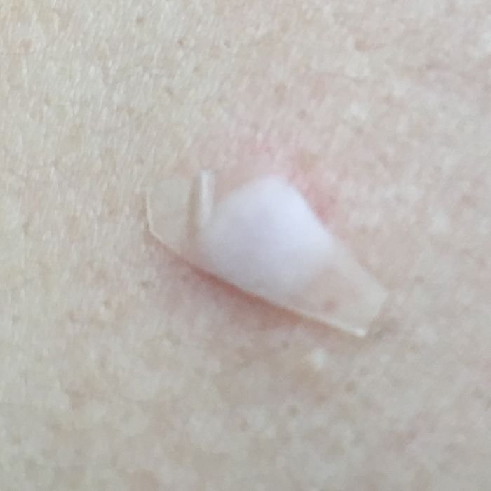 hydrocolloid dressing hydrocolloid dressing